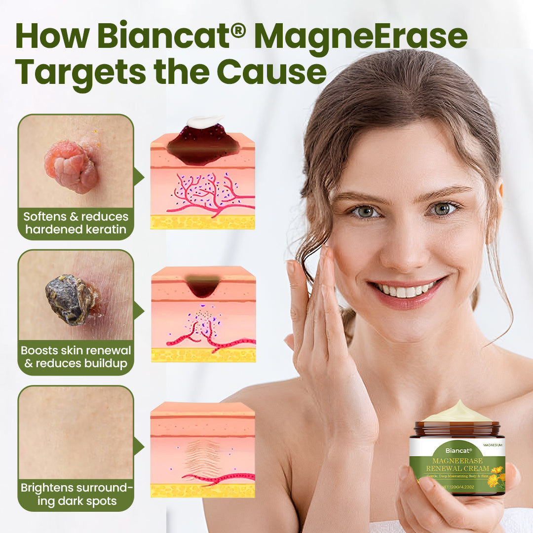 🔥 Cash on Delivery 🔥Biancat® MagneErase Renewal Cream