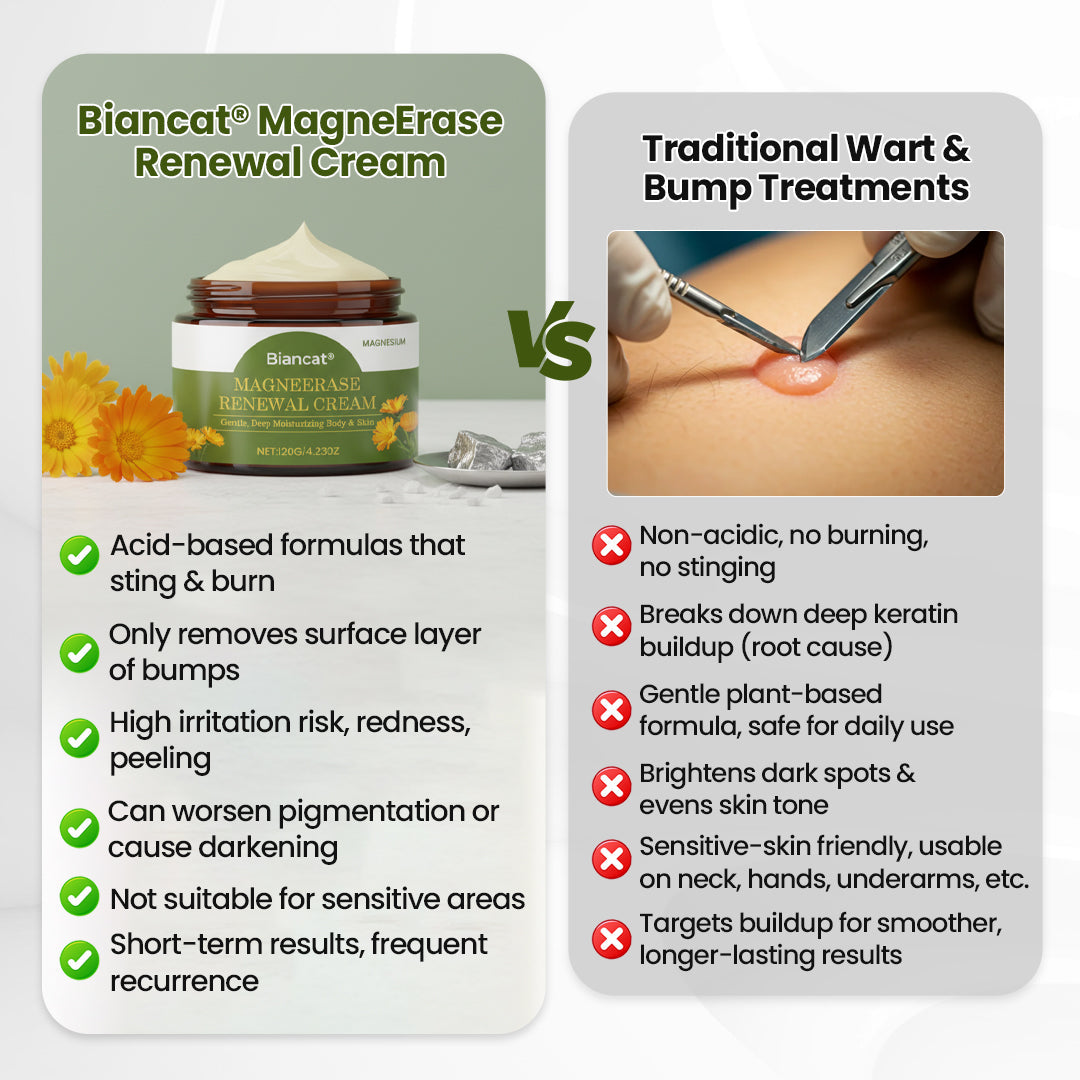 🔥 Cash on Delivery 🔥Biancat® MagneErase Renewal Cream