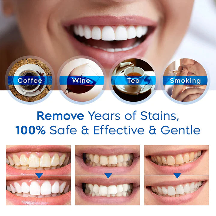 Lanthome™ Teeth Whitening Essence